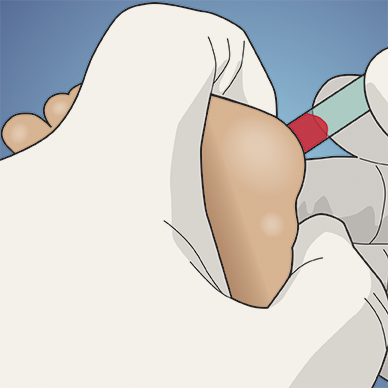 Babylance Newborn hielprik geel, doos 50 stuks - Afbeelding 7