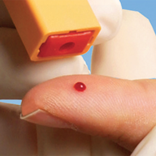 One-Step Safety Lancet, 2.2 mm oranje, doos 100 stuks - Afbeelding 5